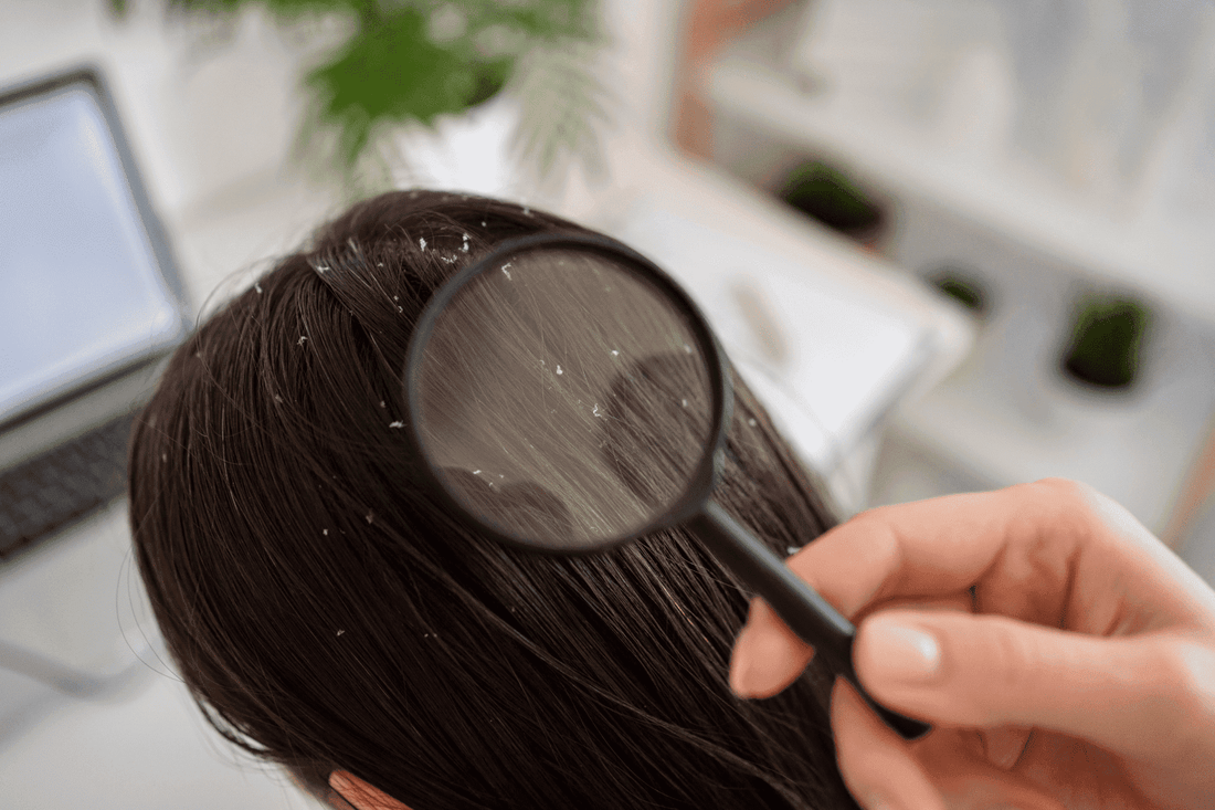 The Hidden Costs: The Overall Negative Effects of Chemical-Based Hair Products on Women